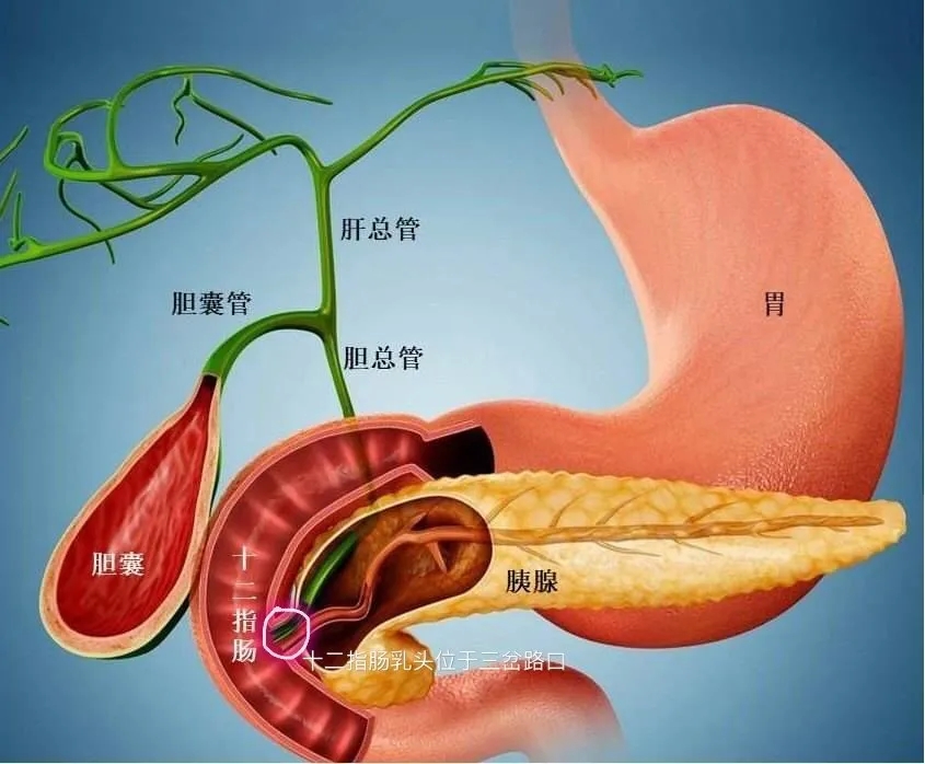 膽囊結(jié)石與胰腺炎之間那不得不說的“秘密”